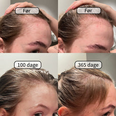 Gainer-Plex Hair Serum™