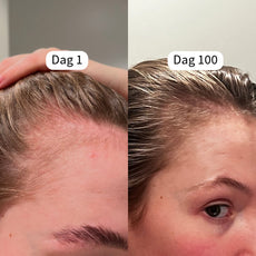 Gainer-Plex Hair Serum™